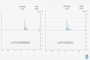 Trasmissione del movimento nel due lati del topper